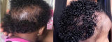 3 Counts Hair Growth Oil