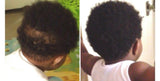 2 Counts Hair Growth Spray