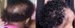 2 Counts Hair Growth Spray