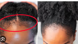 3 Counts Hair Growth Spray